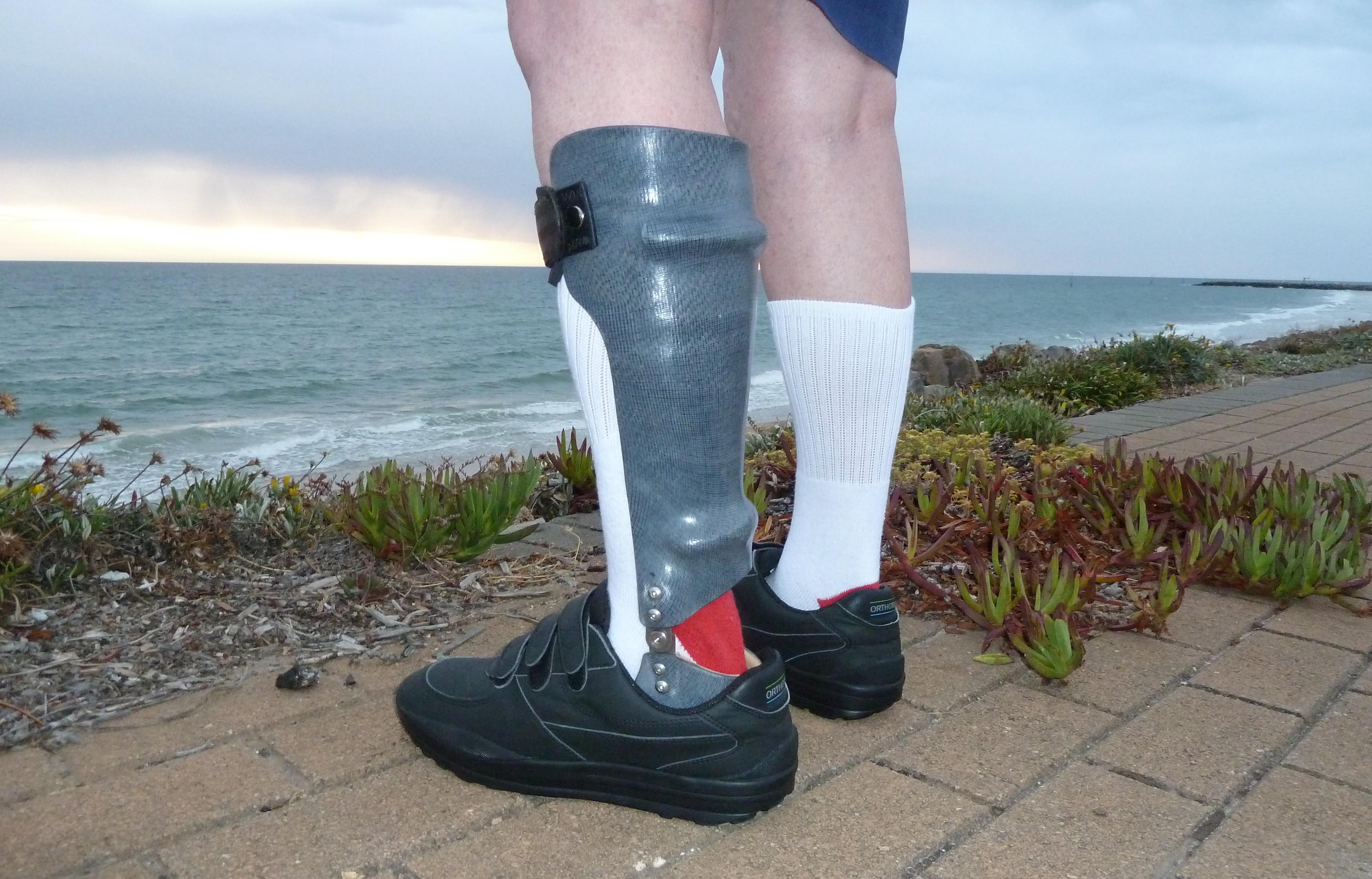 FMO CARBON FIBRE AFO&apos;s