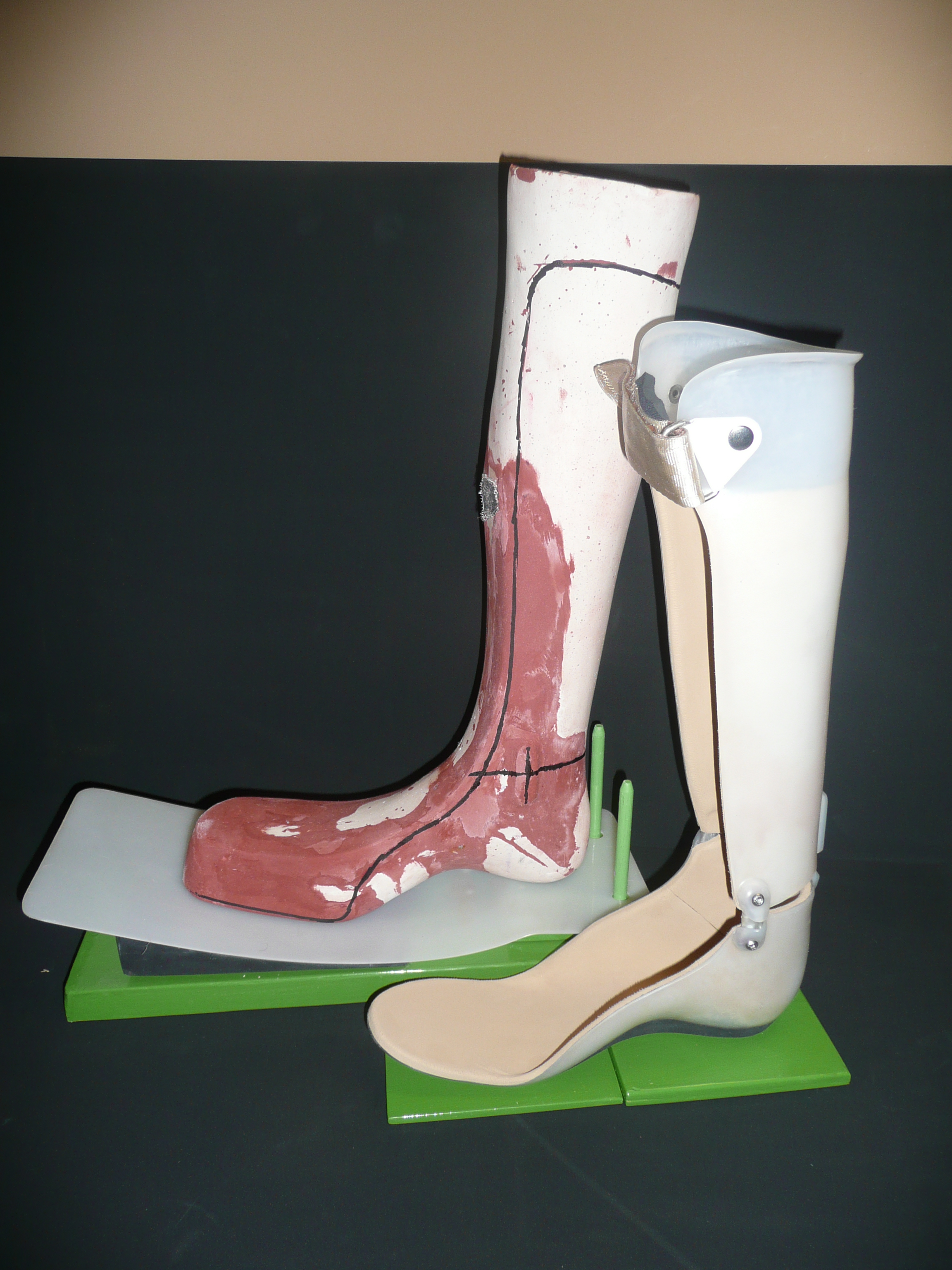 Left AFO/Left Positive Cast