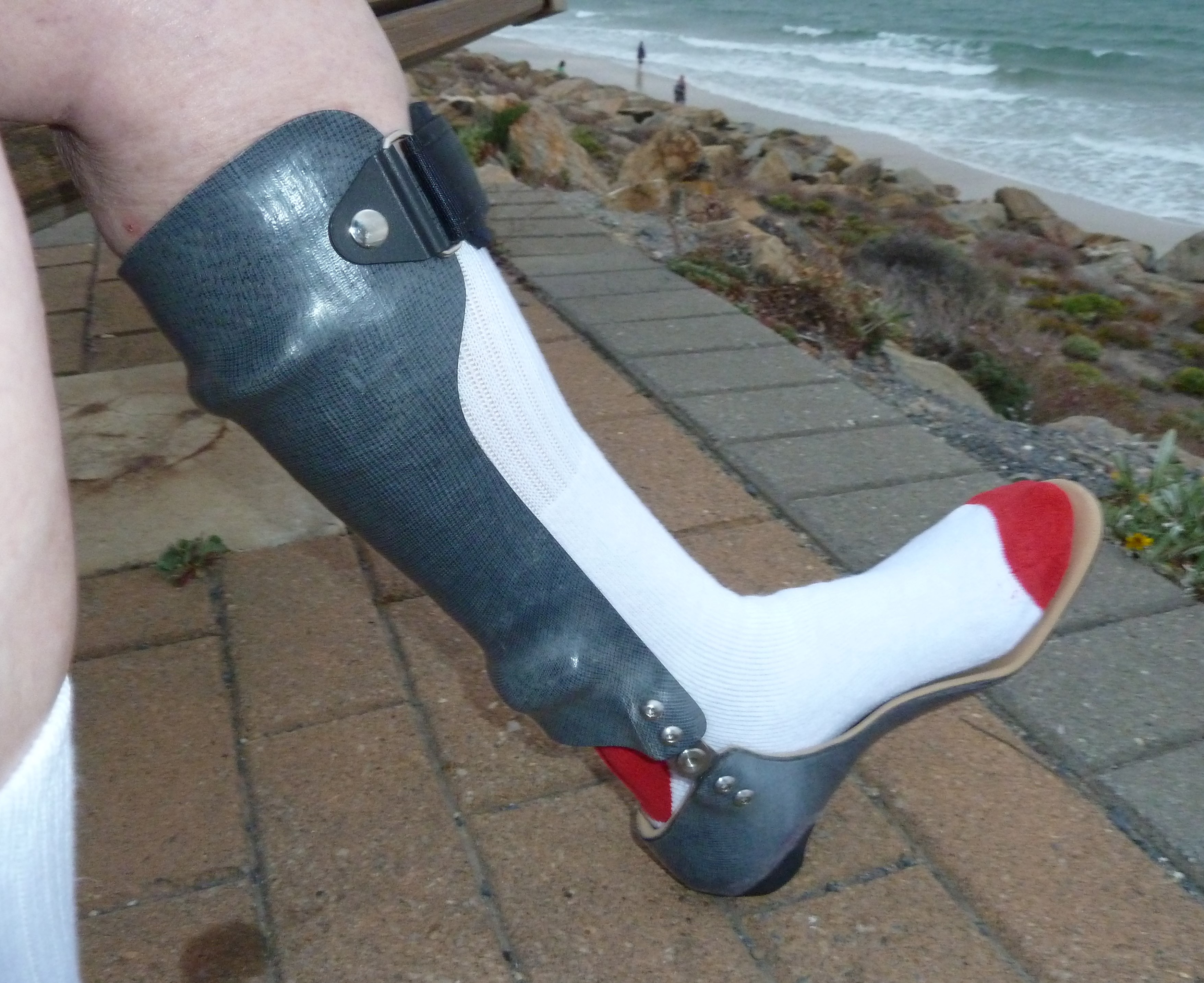 FMO Carbon Fibre AFO&apos;s