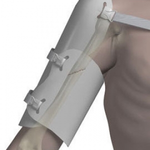 Foot Mechanic Orthotics HUMERAL FRACTURE BRACE 